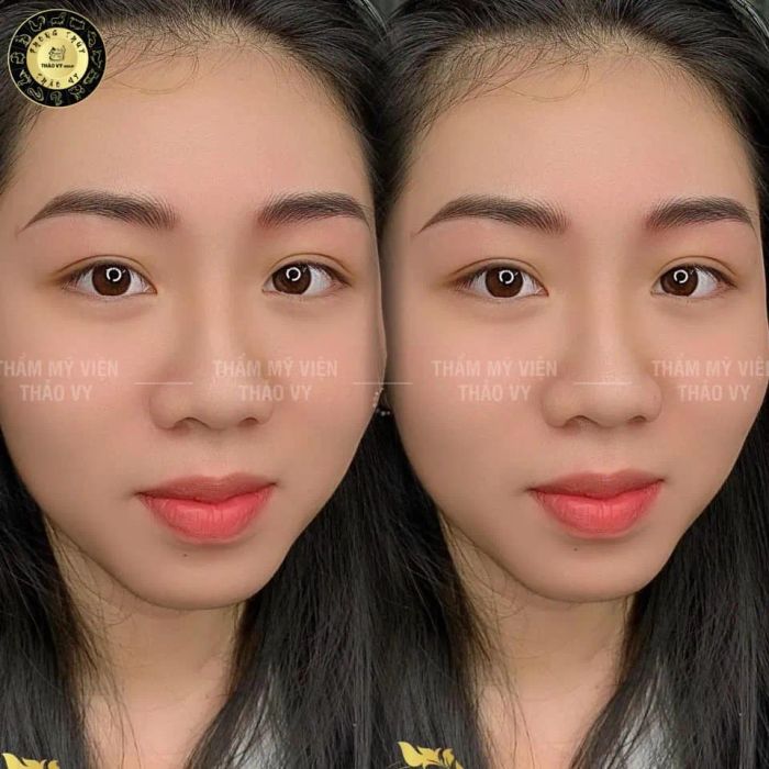 Hình ảnh Thẩm Mỹ Viện Thảo Vy - Dịch vụ phun xăm chất lượng