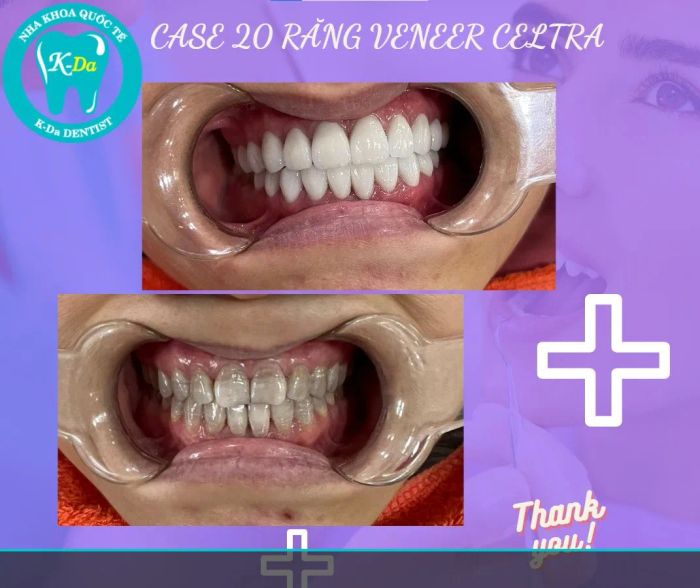 Nha Khoa Quốc Tế K-Da - Hình ảnh 2