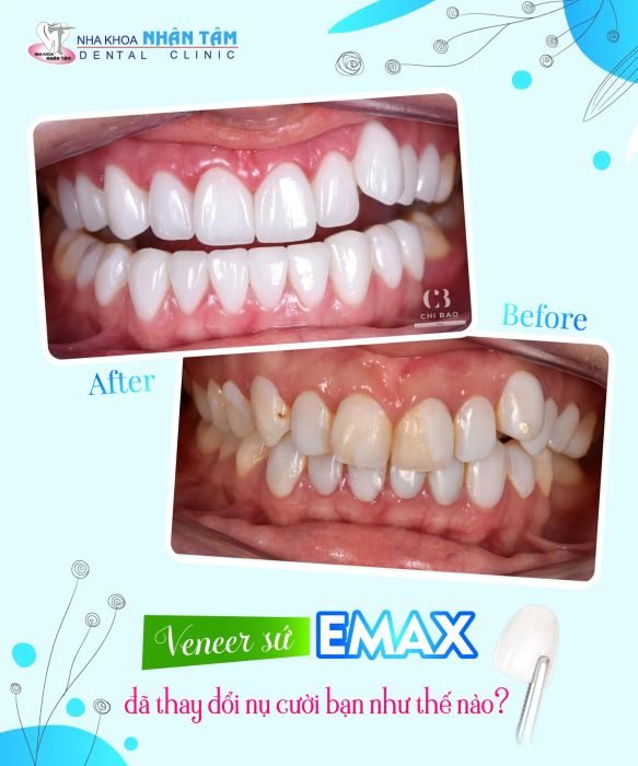 Nha khoa Nhân Tâm - Dental Clinic ảnh 1