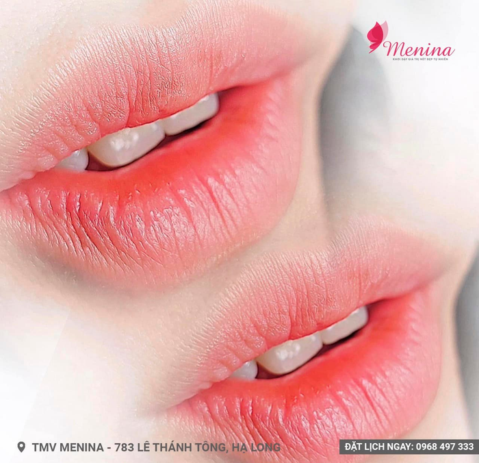 Hình ảnh nổi bật của Thẩm mỹ viện Menina tại Hạ Long