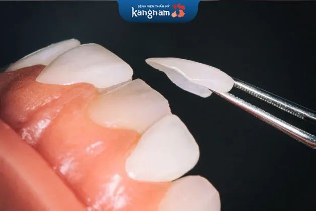 Bệnh viện thẩm mỹ Kangnam - Hình ảnh 1
