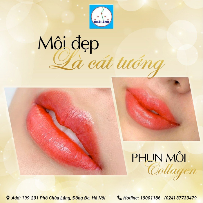 Hình ảnh thứ hai về Thẩm mỹ viện Hoài Anh