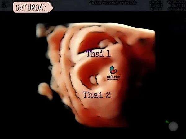 Phòng Khám Phụ-Sản Thiên Đức Bắc Ninh Hình Ảnh 2