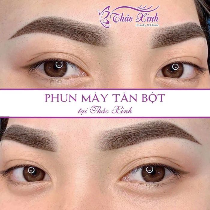 Bộ sưu tập hình ảnh Thẩm Mỹ Viện Thảo Xinh
