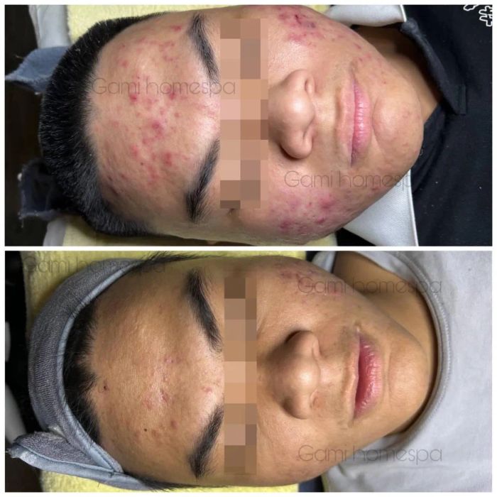 Gami Homespa - Hình ảnh thực tế 1
