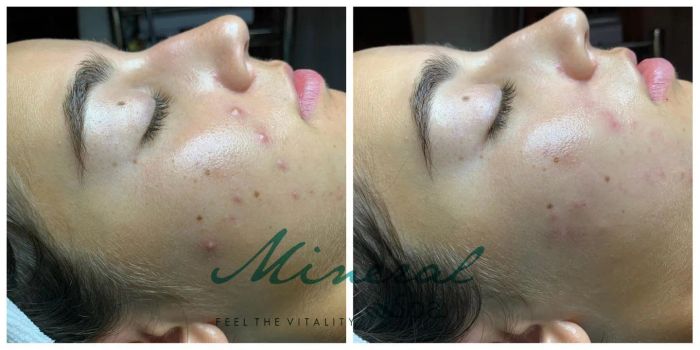 Mineral Spa - Hình ảnh thực tế