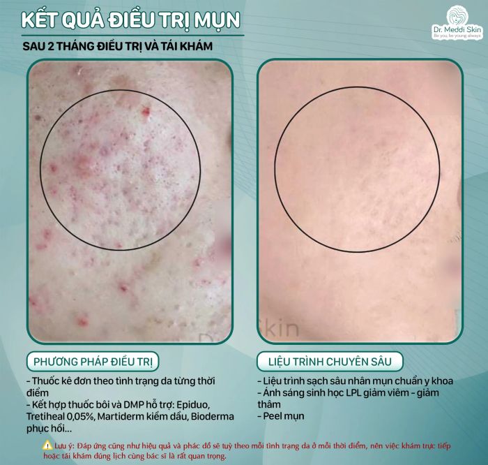 Meddi Skin - Hình ảnh phòng khám