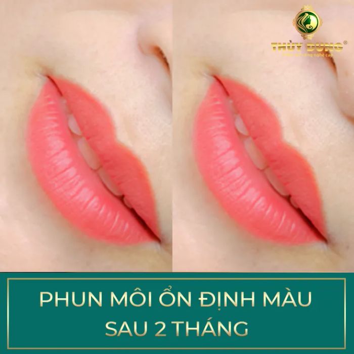 Bộ sưu tập hình ảnh dịch vụ tại Thùy Dung Beauty