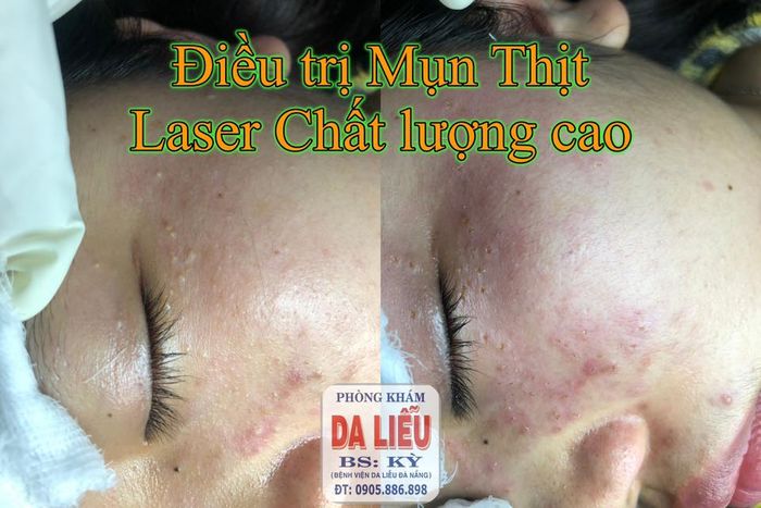 Hình ảnh thực tế Phòng Khám Da Liễu - Thẩm Mỹ Bs Tôn Thất Minh Kỳ