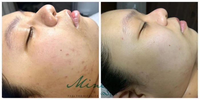 Mineral Spa - Hình ảnh thực tế