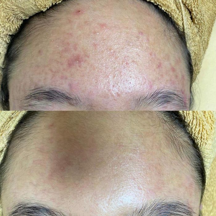 Không gian trị liệu cao cấp tại DK Spa & Clinic