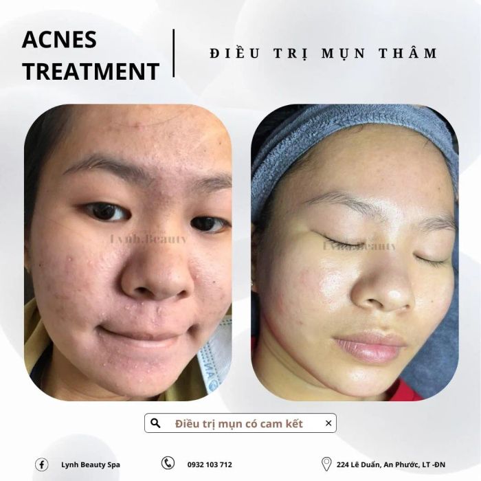 Không gian sang trọng và hiện đại tại Lynh Beauty Spa