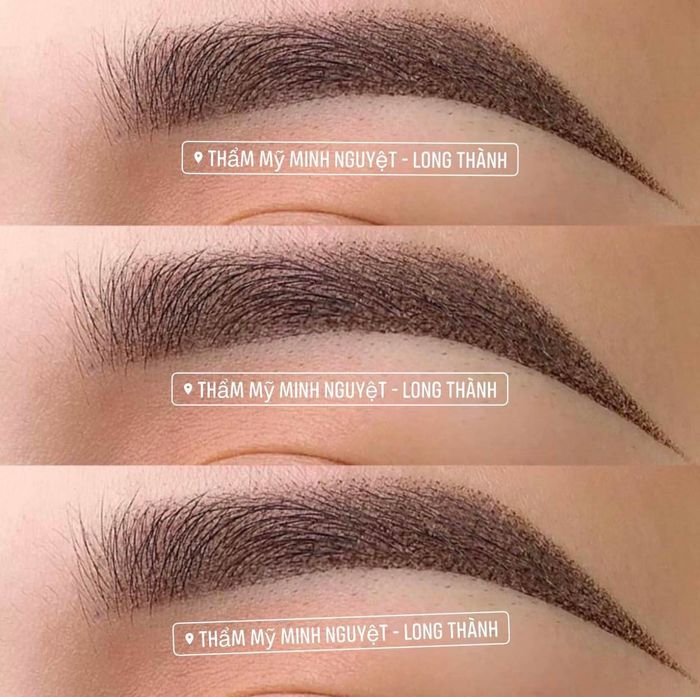 Hình ảnh thực tế tại Thẩm Mỹ Minh Nguyệt - Long Thành - Ảnh 1