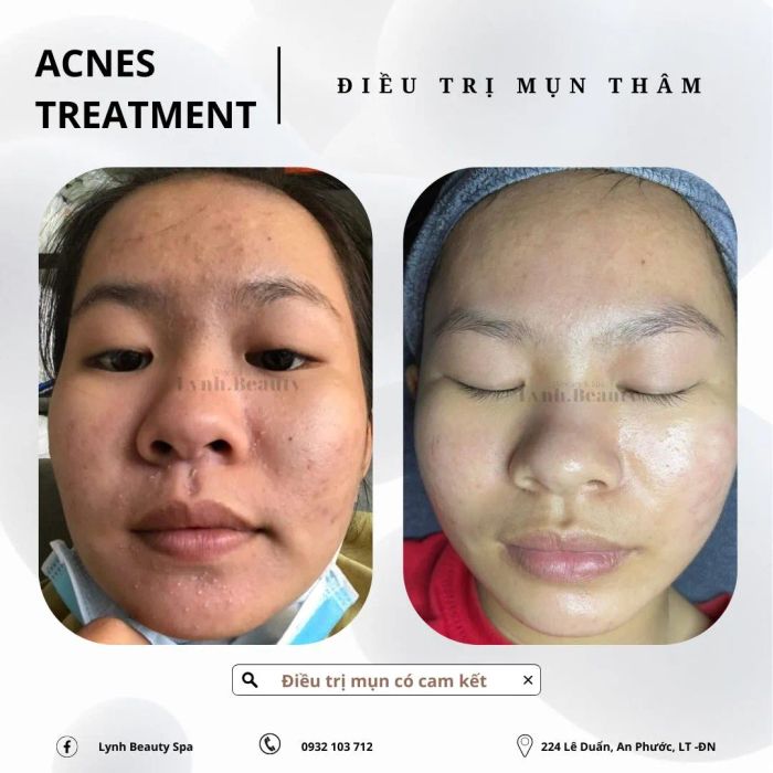 Không gian trị liệu đẳng cấp tại Lynh Beauty Spa