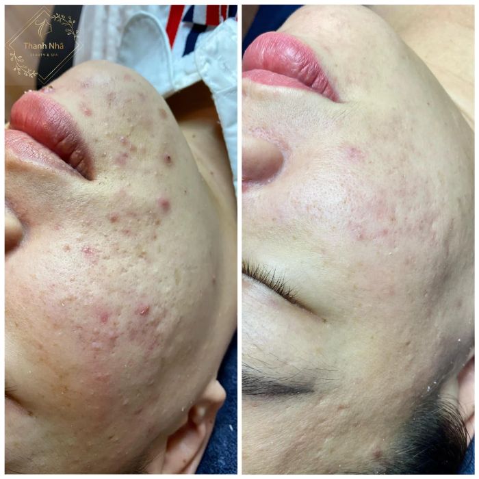 Thanh Nhã Beauty & Spa - Hình ảnh thực tế 2