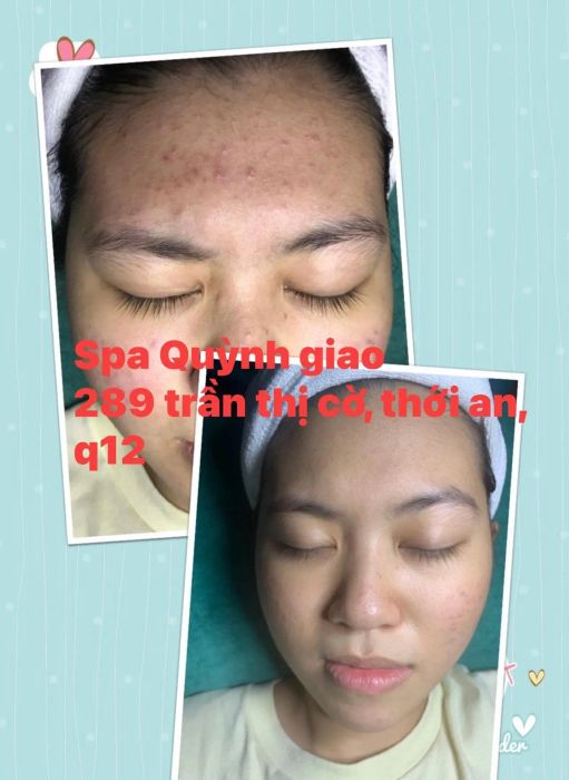 Quỳnh Giao Spa - Hình ảnh thực tế