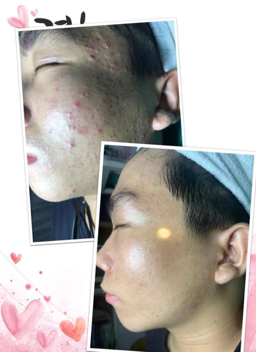 Quỳnh Giao Spa - Hình ảnh trị liệu thực tế