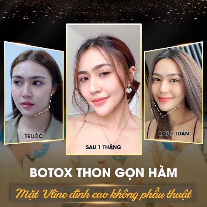 Hệ thống máy móc hiện đại và phòng tiêm chuẩn tại Thẩm Mỹ Viện Xinh Spa Center