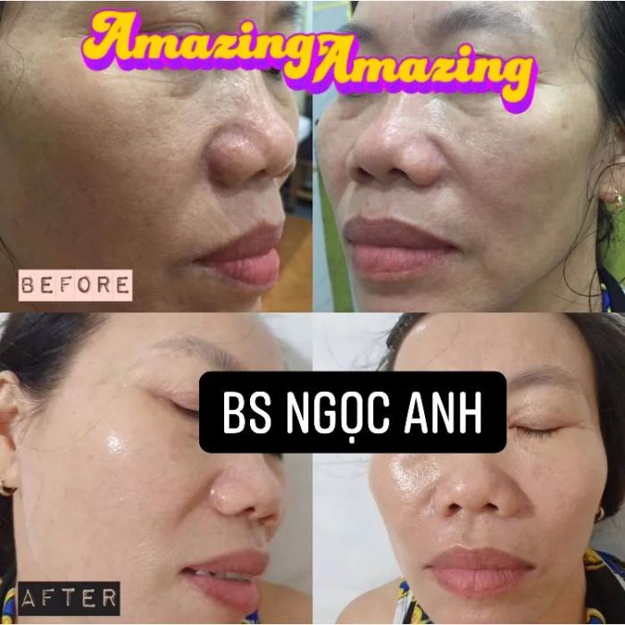 Hệ thống trang thiết bị tiên tiến tại Dr. Ngọc Anh Da Liễu & Thẩm Mỹ