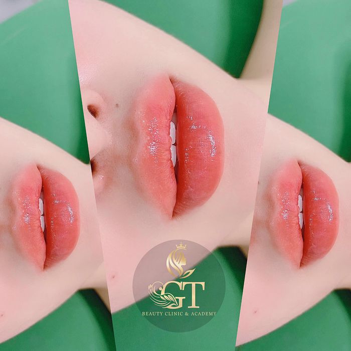 Hình ảnh không gian sang trọng tại GT Beauty & Clinic