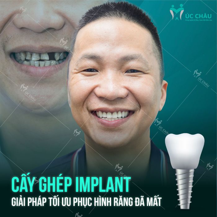 Hình ảnh cơ sở vật chất hiện đại tại Nha Khoa Úc Châu Quảng Ninh