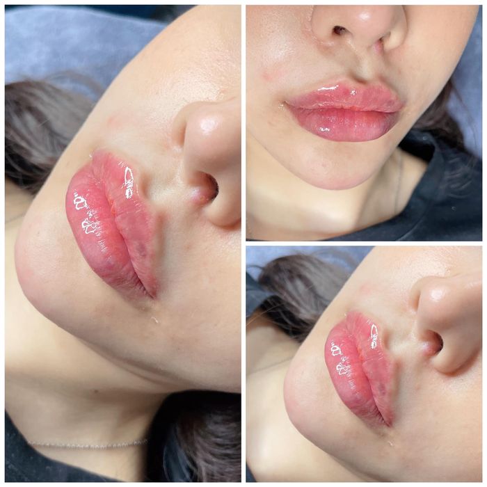Phòng tiêm chuẩn y khoa tại The Dencos Beauty Center