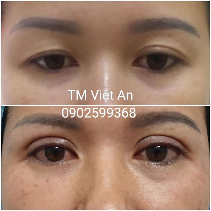 Phòng Khám Mắt Bác Sỹ Hòa – Hình ảnh bác sĩ Hòa đang tư vấn bệnh nhân tận tình (ảnh 2)