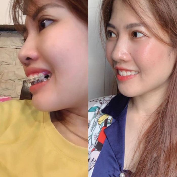 Nha Khoa Bình Dương - Chi nhánh Thuận An hình ảnh 2