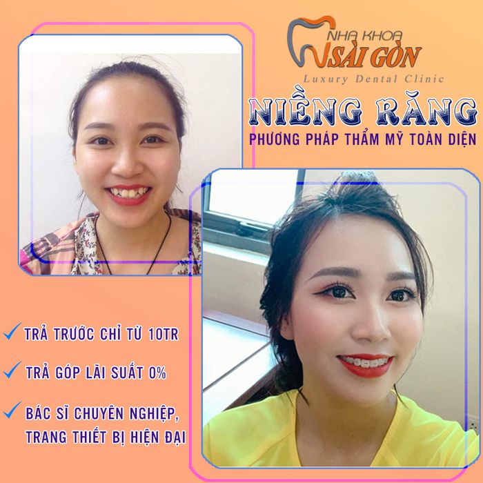 Nha Khoa Sài Gòn - Lái Thiêu hình ảnh 1