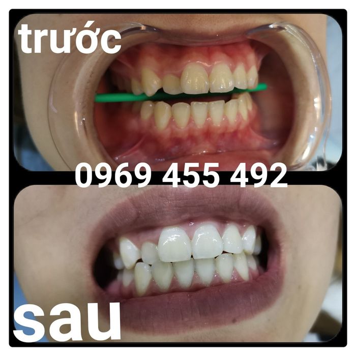 Nha Khoa Tâm Đức hình ảnh 2