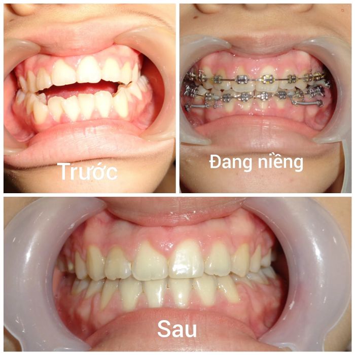 Hệ thống trang thiết bị tân tiến tại Nha Khoa Bến Tre