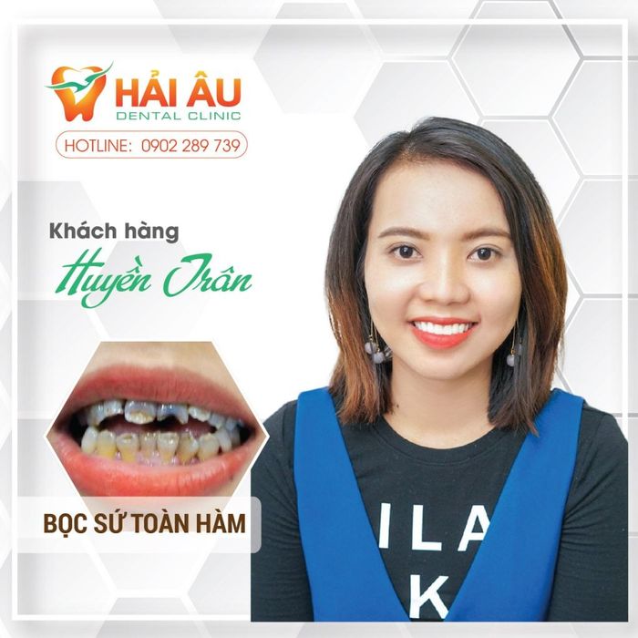 Hình ảnh thực tế tại Nha Khoa Hải Âu