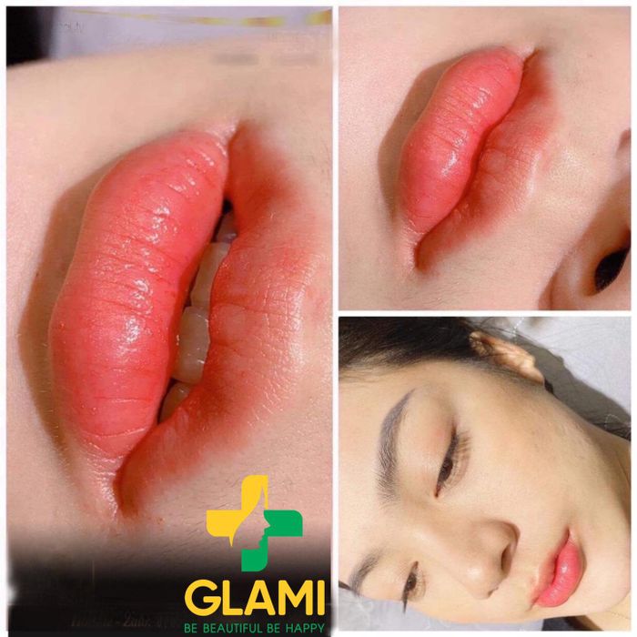 Không gian sang trọng tại Viện Thẩm Mỹ GLAMI 198+ (ảnh 1)