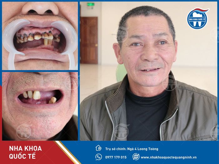 Hình ảnh đội ngũ bác sĩ chuyên gia hàng đầu tại Nha Khoa Quốc Tế Quảng Ninh