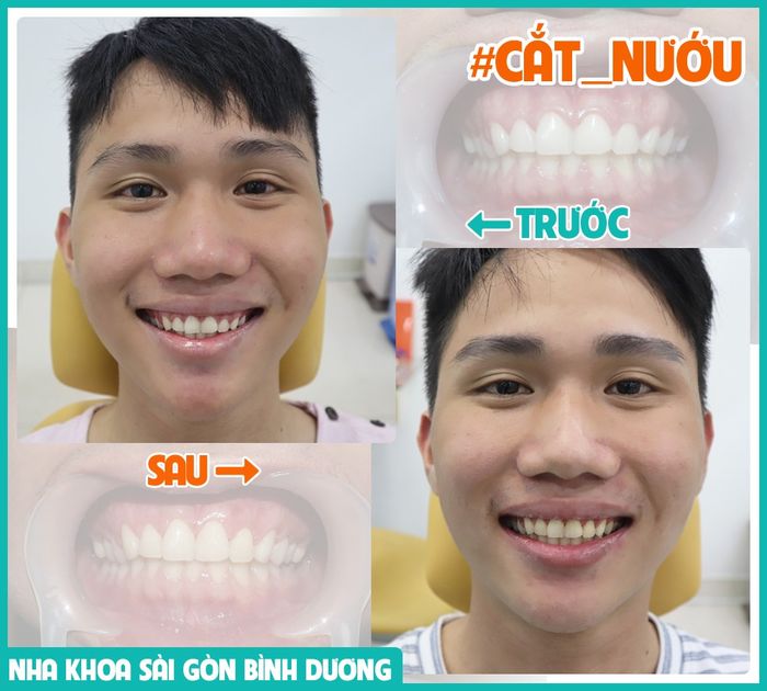 Nha Khoa Sài Gòn Bình Dương hình ảnh 2