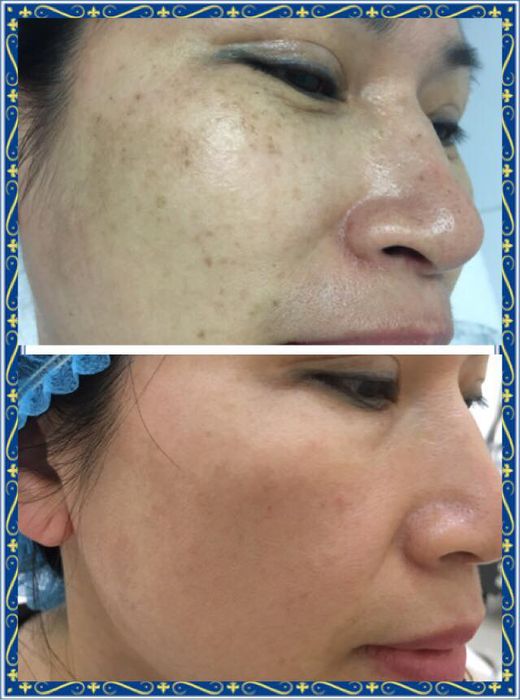 Hình ảnh hệ thống máy móc công nghệ cao tại Phòng Khám Da Liễu Bác Sĩ Hưng