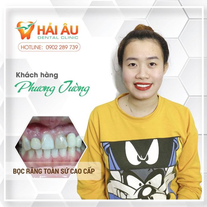 Hình ảnh thực tế Nha Khoa Hải Âu