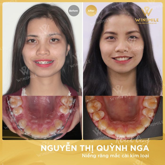 Hình ảnh đội ngũ bác sĩ chuyên môn cao tại Nha Khoa Win Smile