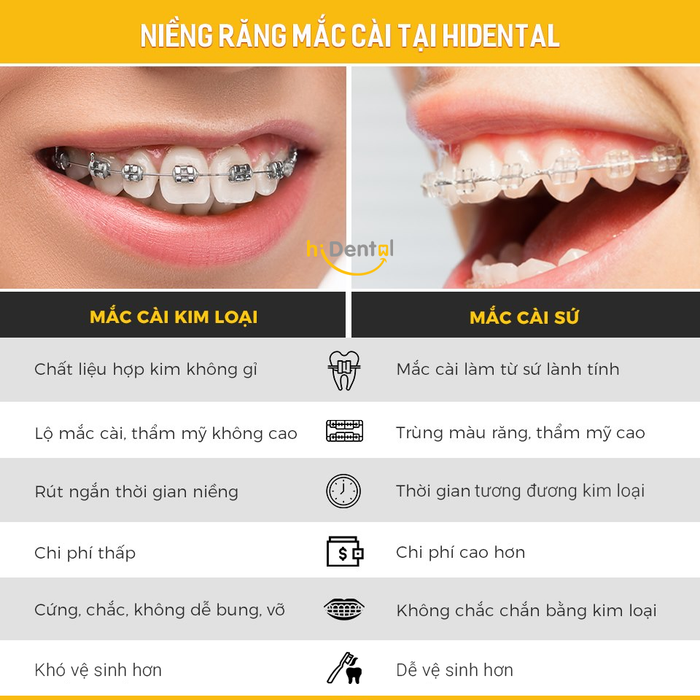 Khám phá không gian hiện đại và quy trình niềng răng chuyên nghiệp tại Nha khoa hiDental qua hình ảnh thực tế