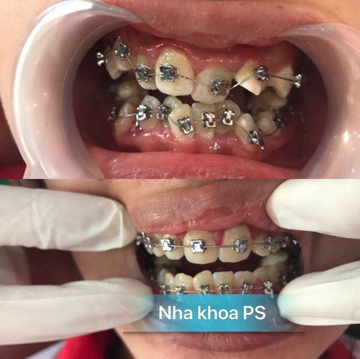 Không gian hiện đại và tiện nghi tại Nha Khoa PS Hưng Yên