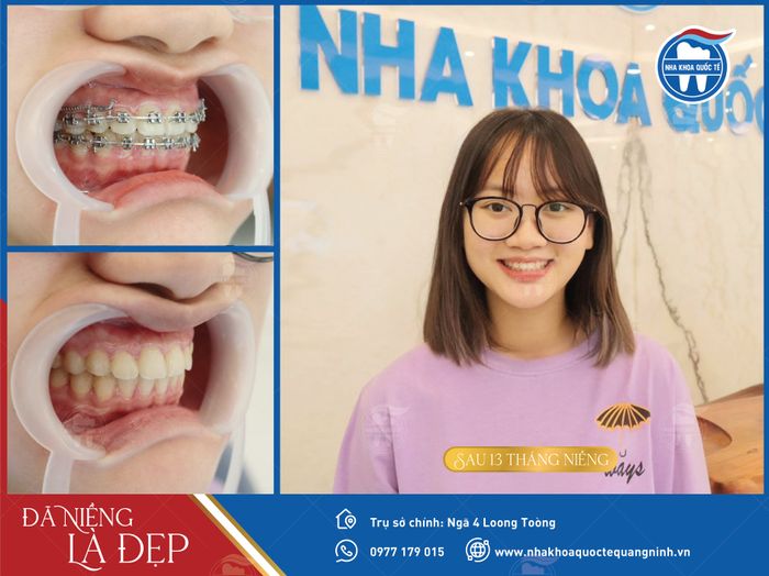 Hình ảnh đội ngũ bác sĩ chuyên nghiệp tại Nha Khoa Quốc Tế Quảng Ninh