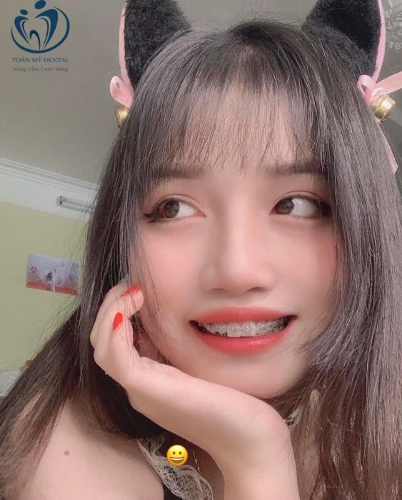 Khám phá không gian hiện đại và dịch vụ chuyên nghiệp tại Nha Khoa Toàn Mỹ qua hình ảnh chất lượng cao.