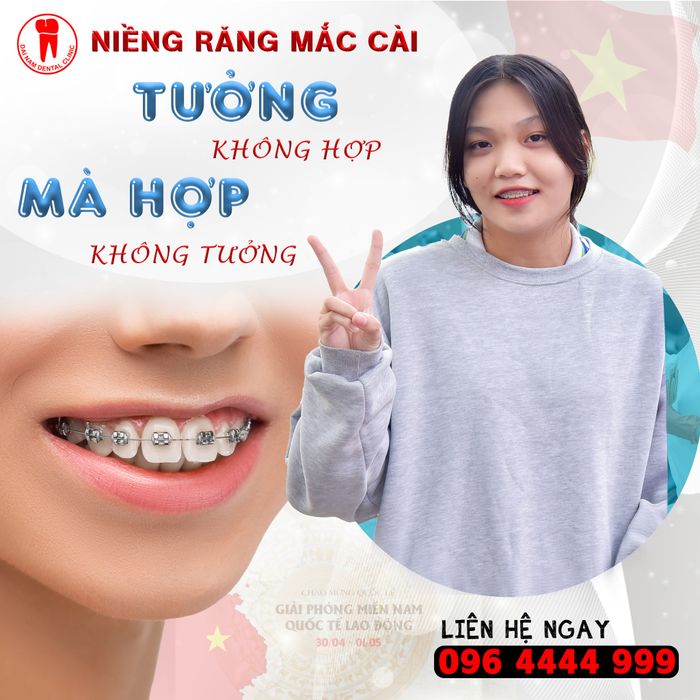 Quy trình niềng răng chuyên nghiệp tại Nha Khoa Đại Nam