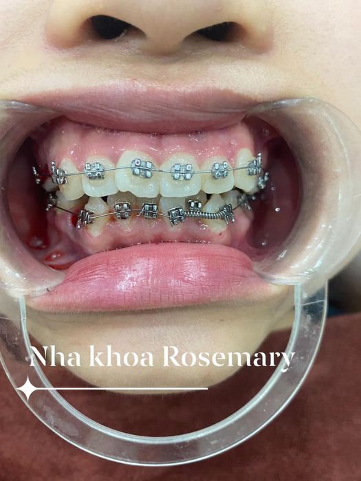 Không gian hiện đại và sang trọng tại Nha Khoa Thẩm Mỹ Quốc Tế Rosemary