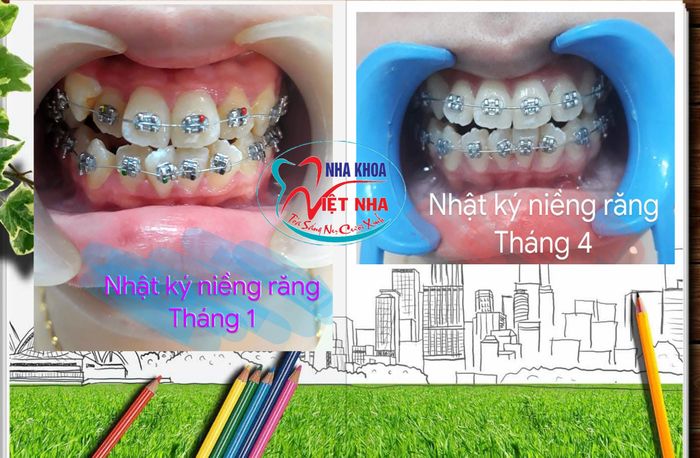 Không gian hiện đại tại Nha Khoa Việt Nha Bình Dương