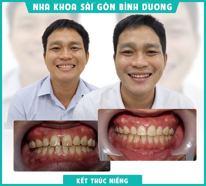 Không gian hiện đại tại Nha khoa Sài Gòn Bình Dương