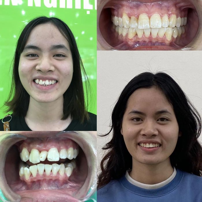 Hình ảnh đội ngũ bác sĩ chuyên môn tại Nha Khoa VinSmile