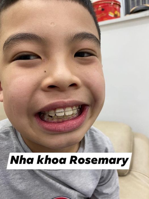 Hệ thống trang thiết bị tối tân tại Nha Khoa Thẩm Mỹ Quốc Tế Rosemary