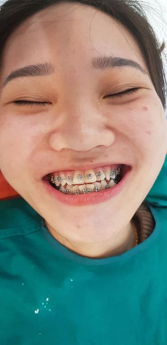 Hình ảnh thực tế về không gian hiện đại tại Nha khoa Quang Tùng