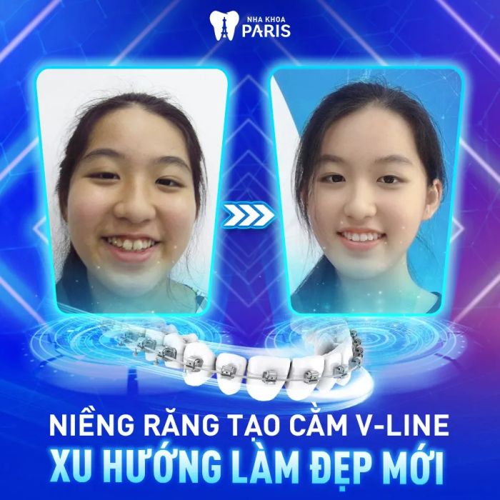 Không gian hiện đại và tiện nghi tại Nha Khoa Paris